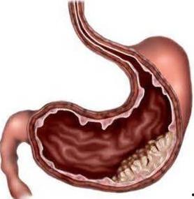 胃炎可以吃蓝瓜,天然食疗新选择  第3张